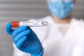 Close up of unrecognizable doctor holding a test tube with a positive sample of Covid-19 virus