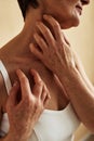 Close up of unrecognizable woman scratching neck itch and allergy