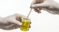 Close Up of Urine Test Analysis with Gloved Hands on Isolated White Background Medical Examination of Urine Sample Using Strip Royalty Free Stock Photo