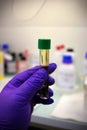 Close-up of a urine test specimen for drug detection and doping