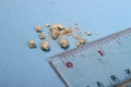 Very small kidney stones with ruler at blue background