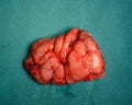 Close-up view of brain specimen after surgery Royalty Free Stock Photo