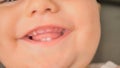 A close-up view capturing the joyful expression of a baby who is smiling and showing two little teeth. The childs eyes