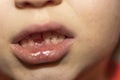 Close up view of child`s mouth with first lost tooth Royalty Free Stock Photo