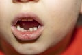 Close up view of child`s mouth with first lost tooth Royalty Free Stock Photo