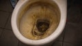 The close up view of the dirty stain inside of the toilet bowl in the house. Yellow limescale stain