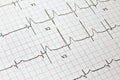 View of ECG or heart beat or health details print out report of patient