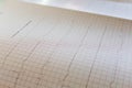 Close up view of an electrocardiogram paper