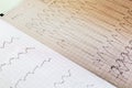 Close up view of an electrocardiogram paper, graphic