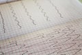 Close up view of an electrocardiogram paper, graphic