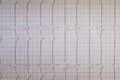 Close up view of an electrocardiogram paper, graphic