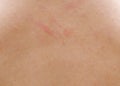 close up view of human skin Royalty Free Stock Photo