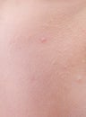 Close up view of a human skin Royalty Free Stock Photo