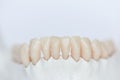 Close-up view of human teeth on jaw bone Royalty Free Stock Photo