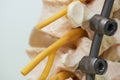 Close-up view of lumbar spine model and instrument fixation