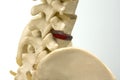 Close-up view of lumbar vertebra model