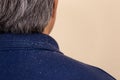 Close-up view of a man who has a lot of dandruff from his hair on his shirt and shoulders