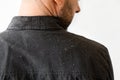 Close up view of man's shoulders in black shirt covered with dander. Back view. Copy space. The concept of psoriasis