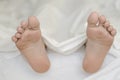 Close up view of men feet isolated on white sheet background laying on bed. Peeling flaky dry.