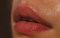 Close-up of wet nature lips. Lips with gloss makeup. Filler Injections, Plastic Surgery, Collagen and Treatments.