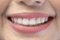 Close up of white healthy teeth of beautiful smile young woman Royalty Free Stock Photo