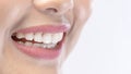 Close up of white healthy teeth of beautiful smile young woman Royalty Free Stock Photo