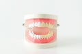 Close up of white and yellow teeth model with red gum on white b Royalty Free Stock Photo