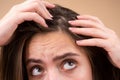 Close up of woman examining her scalp and hair, hair loss on hairline or dry scalp problem.