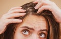 Close up of woman examining her scalp and hair, hair loss on hairline or dry scalp problem.