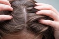 Close up of woman examining her scalp and hair, hair loss on hairline or dry scalp problem.