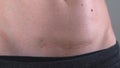 Close up of woman`s belly with cesarean scar. Postpartum recovery. Baby delivery operation. Fit woman after birth