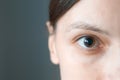 Close-up of a woman's brown eye with dilated big pupil after eye drops. Royalty Free Stock Photo