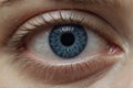 Close-up of a woman's eye with reddened blood vessels.