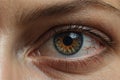 Close-up of a woman's eye with reddened blood vessels.