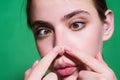 Close up Woman squeeze out pimples on nose. Acne and pimple on skin. Dermatology, puberty woman. Pimples problem. Girl Royalty Free Stock Photo