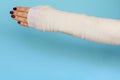 Woman with broken arm bone in cast, plastered hand on blue background. Royalty Free Stock Photo