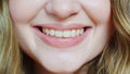 close-up. a woman's smile with natural color teeth.