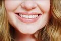 close-up. a woman's smile with natural color teeth.