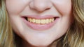 close-up. a woman's smile with yellow teeth. Royalty Free Stock Photo