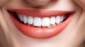 Close Up of Womans Mouth With White Teeth