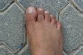 Close up of women`s foot isolated on a concrete floor background. Foot is ugly, dark brown and it has hair and veins showing. No