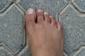 Close up of women`s foot isolated on a concrete floor background. Foot is ugly, dark brown and it has hair and veins showing. No