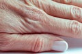 Close up of the wrinkled skin on the hand of an older woman with some lesions of actinic keratosis or sunspots