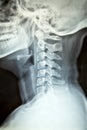 Close up x-ray film show cervical spine or c-spine, neck bones x-ray film. Royalty Free Stock Photo