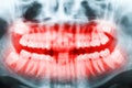 Close-up x-ray image of teeth and mouth Royalty Free Stock Photo