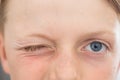 Close up of an 8 year old`s blue eyes