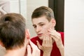 Close up of young attractive man with problematic skin and scars from acne looks in the mirror in the bathroom