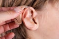 Close up of a young boy`s ear and a doctor holding a hearing aid Royalty Free Stock Photo