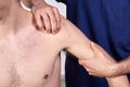 Close-up of a young man having chiropractic shoulder adjustment. Physiotherapy, sports injury rehabilitation. Osteopathy, Royalty Free Stock Photo