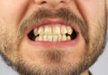 Closed human teeth grin, closeup Royalty Free Stock Photo